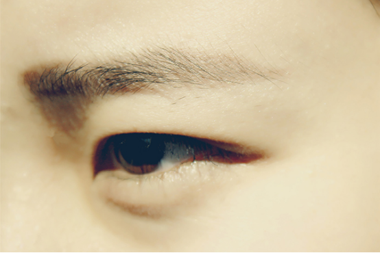 下眼皮里面长了个小疙瘩 下眼皮里面长了个小疙瘩