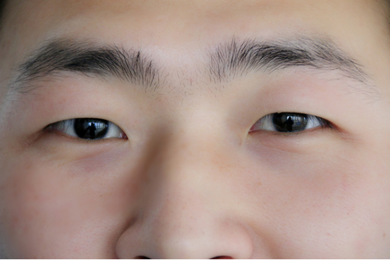 眼白发黄是怎么回事 眼白发黄是怎么回事