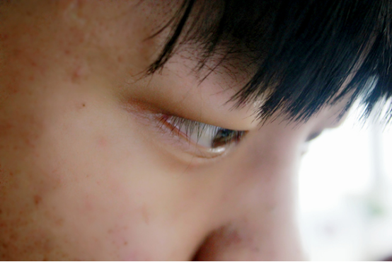 眼皮里面长了个小白点是怎么回事 眼皮里面长了个小白点是怎么回事