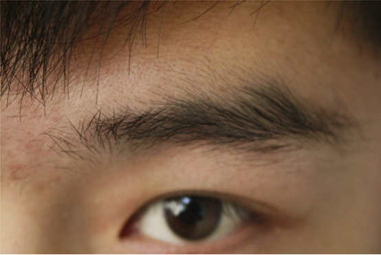 眼皮跳是什么原因造成的 眼皮跳是什么原因造成的