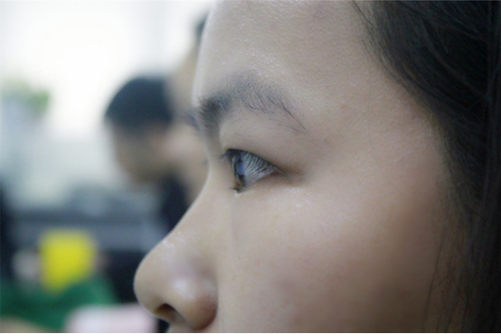 左眼皮一直抽搐 左眼皮一直抽搐