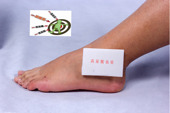 通常治疗尿酸高时会借助药物