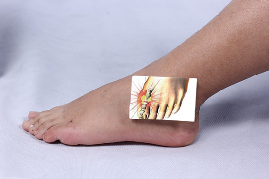 人体代谢不出去的垃圾还出在关节处堆积出结晶体