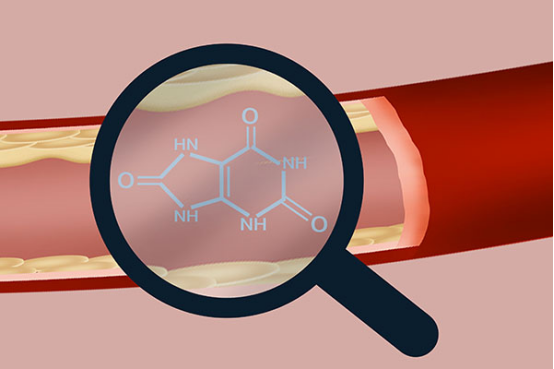 男性的尿酸正常水平和女性的正常尿酸水平是不一样的