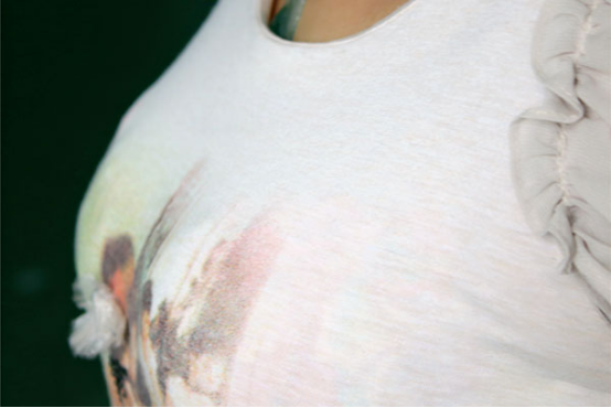 不良的情绪是引起乳腺结节的一种常见因素 不良的情绪是引起乳腺结节的一种常见因素