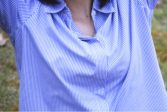 急性的乳腺炎,多在哺乳期出现,症状很重,发作也急 急性的乳腺炎,多在哺乳期出现,症状很重,发作也急