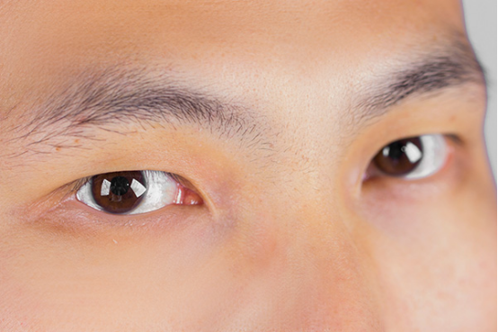 如何提高眼睛视力