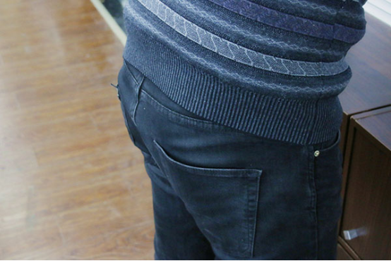 　炎性外痔疮患病时人会有肛门疼痛