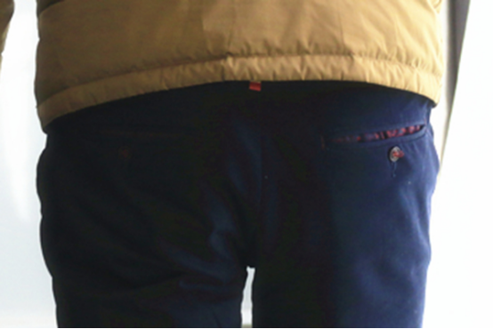 根据内痔脱出的程度，采取不同的处理办法