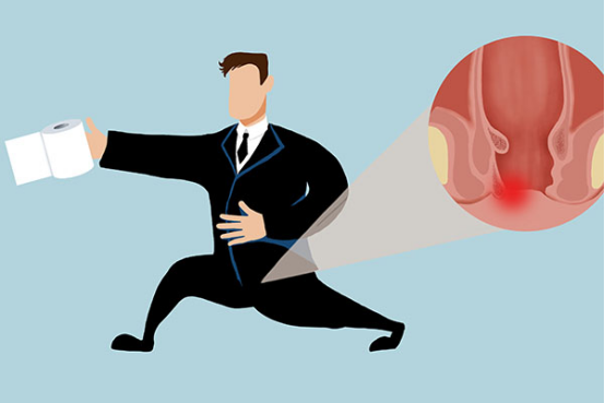 混合痔治疗方法主要有三种方法，不同病情的患者适合不同的治疗方法