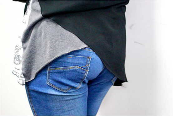 肛周赘生物可能是痔疮,痔疮分为内痔和外痔 肛周赘生物可能是痔疮,痔疮分为内痔和外痔