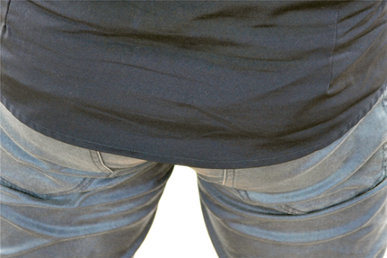 痔疮引起的肿胀，跟肛门部位的血液循环不畅通有很大的关系