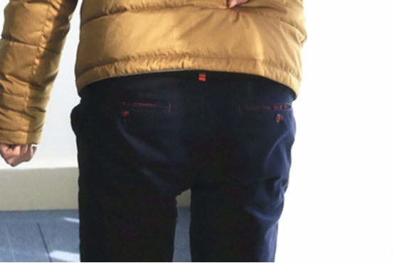 痔疮手术后恢复的时间，要根据病情的严重程度来判断