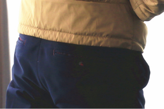 痔疮导致的肉球，不会自动消失