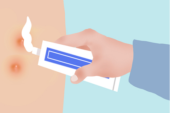 烫伤是不可以使用牙膏的,这一做法不能够缓解烫伤 烫伤是不可以使用牙膏的,这一做法不能够缓解烫伤