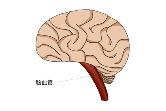 至少60%左右的脑供血不足是颈椎病造成的 至少60%左右的脑供血不足是颈椎病造成的