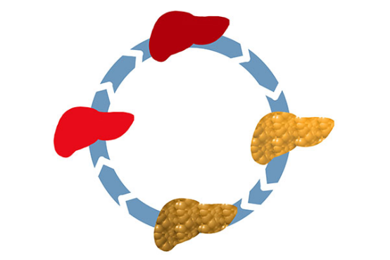 出现消化不良症状时要及时的检查，可能是肝硬化造成的