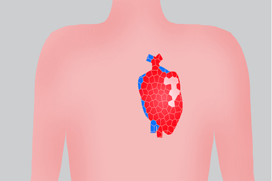 由于引起心脏偏大的原因是不一样的 由于引起心脏偏大的原因是不一样的