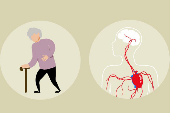 窦性心律过缓的问题可以通过饮食的方式来治疗 窦性心律过缓的问题可以通过饮食的方式来治疗