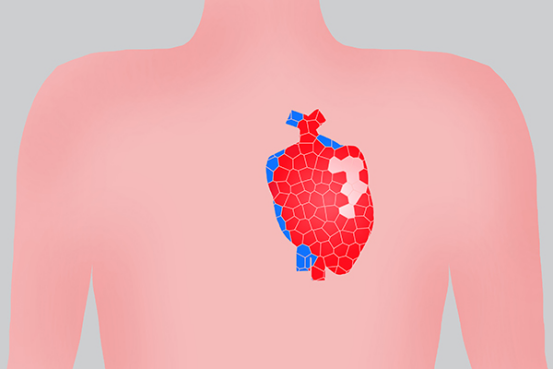 先天性心脏病的患者要采用手术治疗的方式