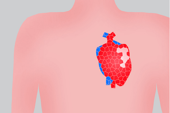 心衰患者以药物治疗为主，必要时要进行手术治疗