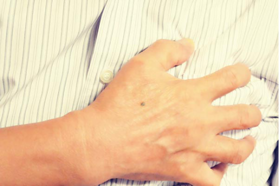 窦性心律过缓的患者，一般看起来都是弱不禁风的样子