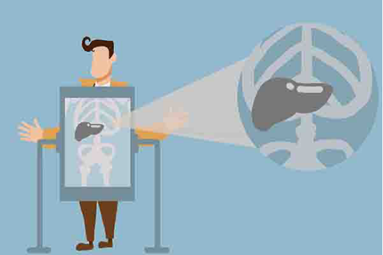 肝硬化患者，患病初期，会有食欲不振的症状，总是感觉自己没有胃口