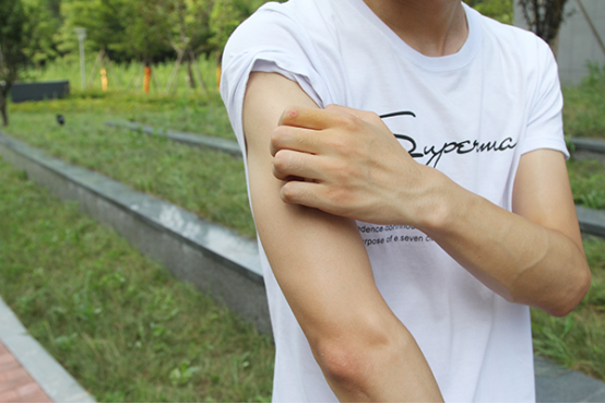 红斑狼疮症刚开始症状不是很明显，容易长在身上比较显著的位置