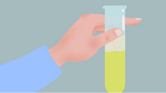 正常情况下，二十四小时尿蛋白定量的值，应该不超过一百五十毫克