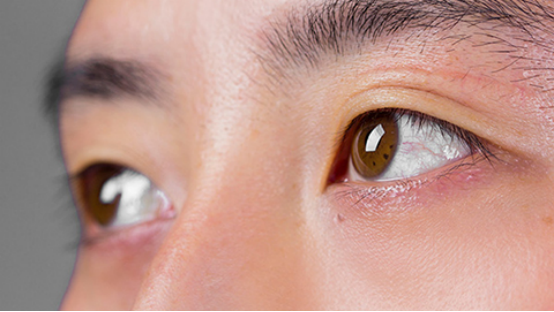 可以通过测量眼压判断是否患有青光眼,正常人眼睛内的压力不超过二十
