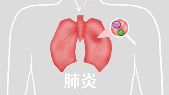 支气管炎和肺炎有一个明显的区别是，支气管炎一般是上呼吸道感染引起的