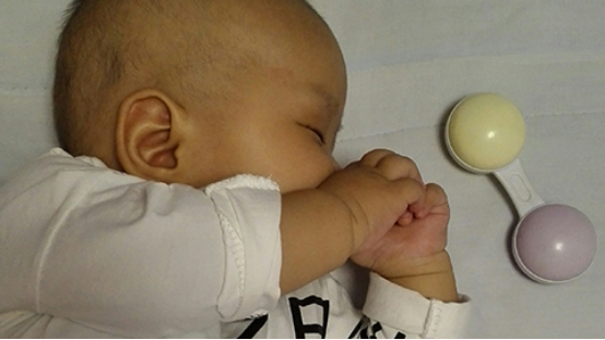 新生儿出生的2到3天左右就会出现黄疸