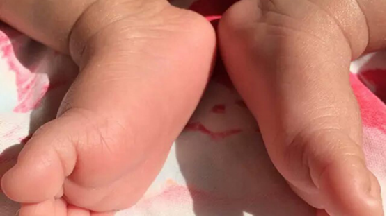 新生儿通过足底抽血，能够及时的诊断出有没有患上地中海性贫血