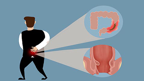 　痔疮手术后排便困难是大多数患者存在的问题