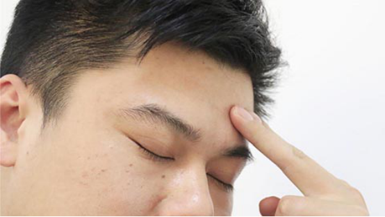 额头发黄是什么原因造成的