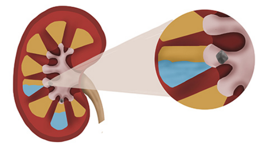 肾衰患者平时可以适当补充维生素