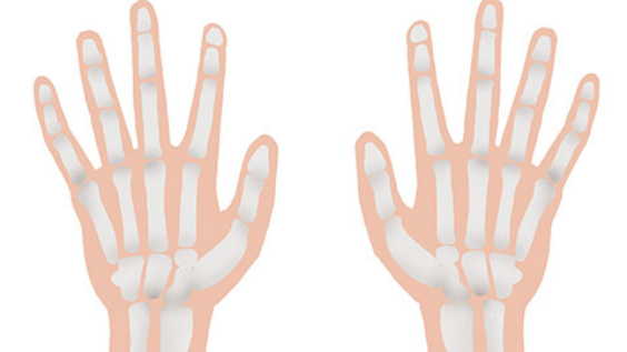 四肢骨头疼痛一般情况下都是劳累过度导致的