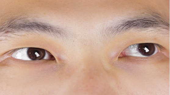 眼睛看东西有雾是怎么回事_民福康