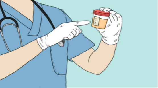 尿常规镜检红细胞偏高是什么原因