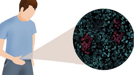 人体的尿液也能会引起尿道炎