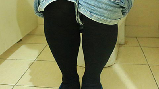 女生经常的发生尿路感染是因为女生的身体构造问题