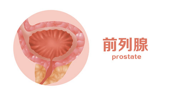 前列腺增生，是很多男同志在一定的阶段大多都会发生的一件事情