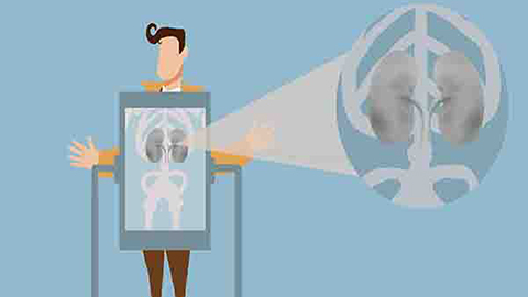 多囊肾通常的症状为腹部疼痛、腰痛、高血压,出现尿血、少尿、无尿等 多囊肾通常的症状为腹部疼痛、腰痛、高血压,出现尿血、少尿、无尿等