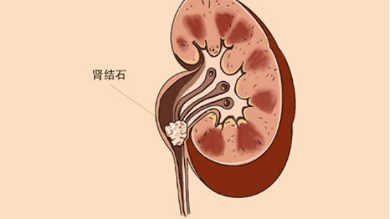 肾脏部位出现毛病，就会影响到我们人体的排泄功能