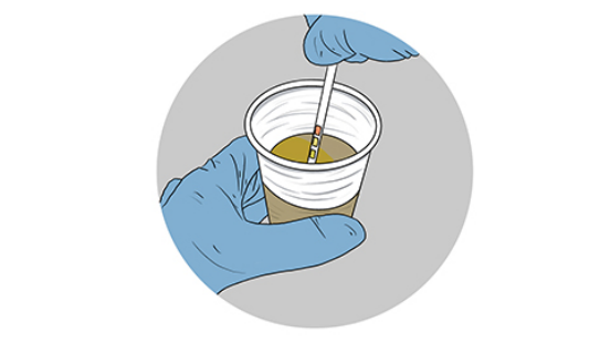 尿毒症会对身体带来严重的伤害