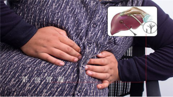 出现血管斑块多是因为日常饮食习惯不好，经常吃高脂肪、高糖的食物