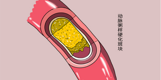 这些块状物质主要是纤维蛋白和钙质的沉淀堆积为主