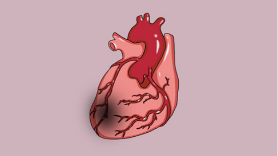 心梗患者饮食上，尤其要注意少吃高脂食物