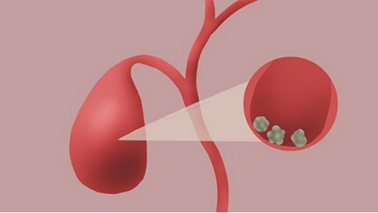 患者可以多吃糙米、全麦面包、芹菜等等