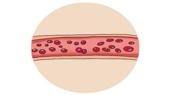血液粘稠可以先通过食补来进行调理